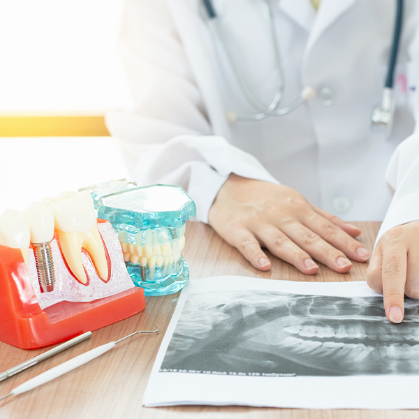 欣隆牙醫專業醫師團隊進行微創植牙，精準定位減少傷口腫痛。位於基隆長庚商圈與城上城社區旁，是橘郡住戶信賴的人工植牙專科診所。