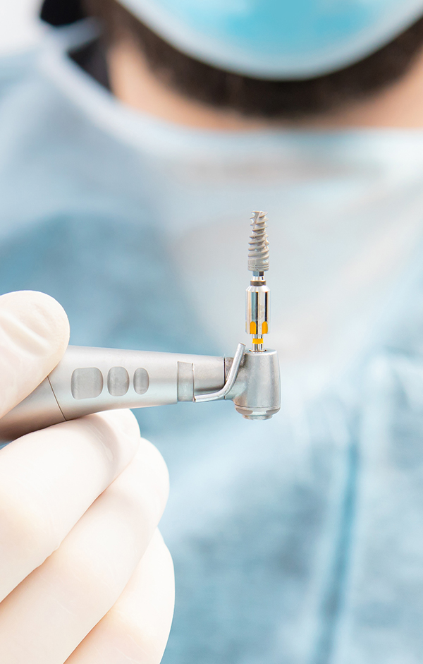 欣隆牙醫與欣城牙醫鄰近城上城，提供數位導引人工植牙，精準定位傷口小。針對橘郡與長庚商圈缺牙患者，我們提供透明的植牙價格與專業術後追蹤，重拾咀嚼功能。