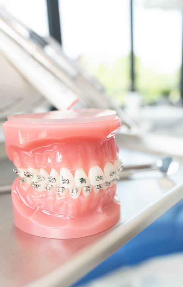 基隆齒顎矯正隱形矯正推薦欣隆牙醫欣城牙醫 欣隆牙醫與欣城牙醫提供專業齒顎矯正諮詢。無論是傳統牙套或是隱適美，我們針對城上城與橘郡社區的青少年及成人，提供客製化矯正方案，讓您在長庚商圈就能享受美感與專業兼具的牙齒矯正服務。