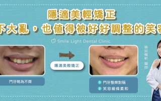 想要改善臉型？城上城推薦欣隆牙醫、欣城牙醫的隱適美隱形矯正。我們提供詳細的矯正價格分析與 2026 最新案例分享，讓您在長庚商圈就能享受舒適且美觀的牙齒矯正體驗。